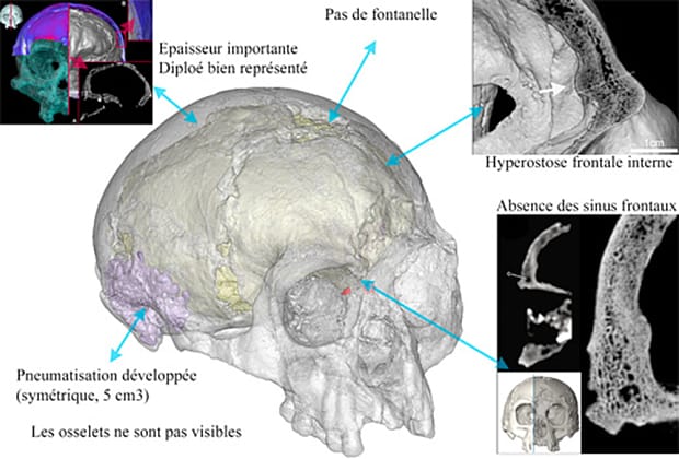 Revision of some internal features of Liang Bua 1 on cranial thickness, internal structure  Photo: Antoine Balzeau-CNRS/MNHN
