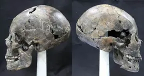 Researchers unearth strange Alien-like, elongated Skull in Korea