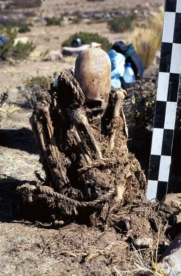 Researchers in Bolivia find two skeletons with abnormally elongated skulls