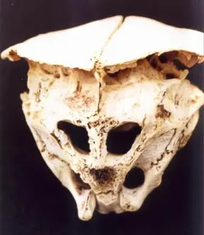 The Rhodope Skull: The mysterious cranium of a real-life Alien?