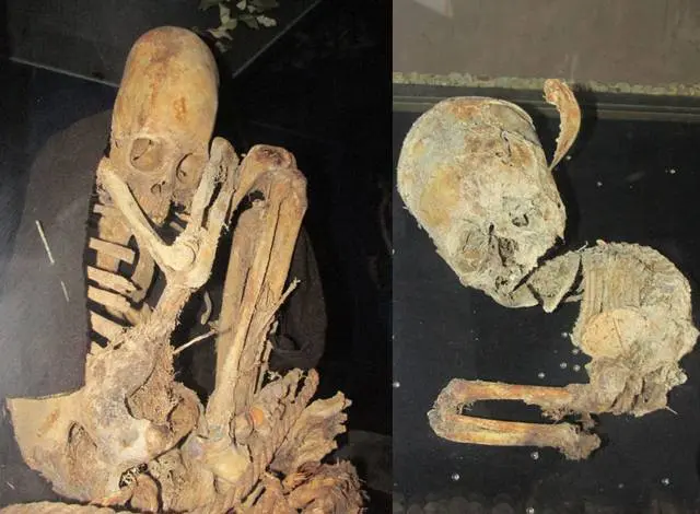 Unusual features elongated skulls