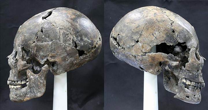 Researchers unearth strange Alien-like, elongated Skull in Korea