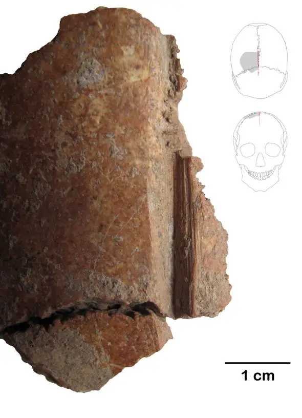 04 neolithic skull