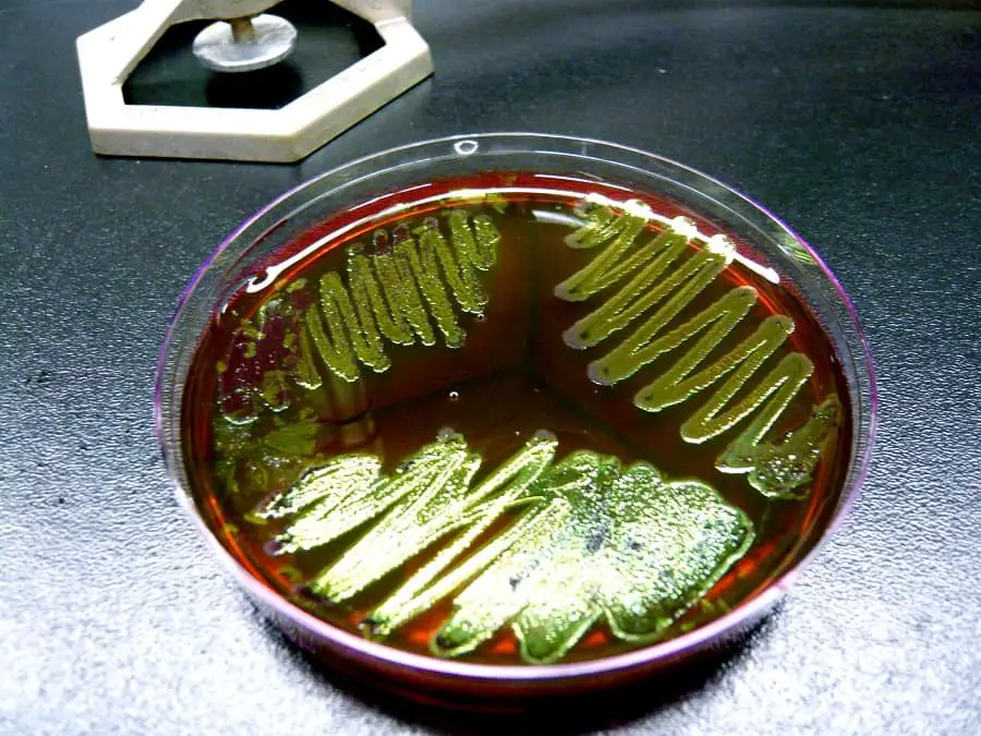 Bacteria in a petri dish