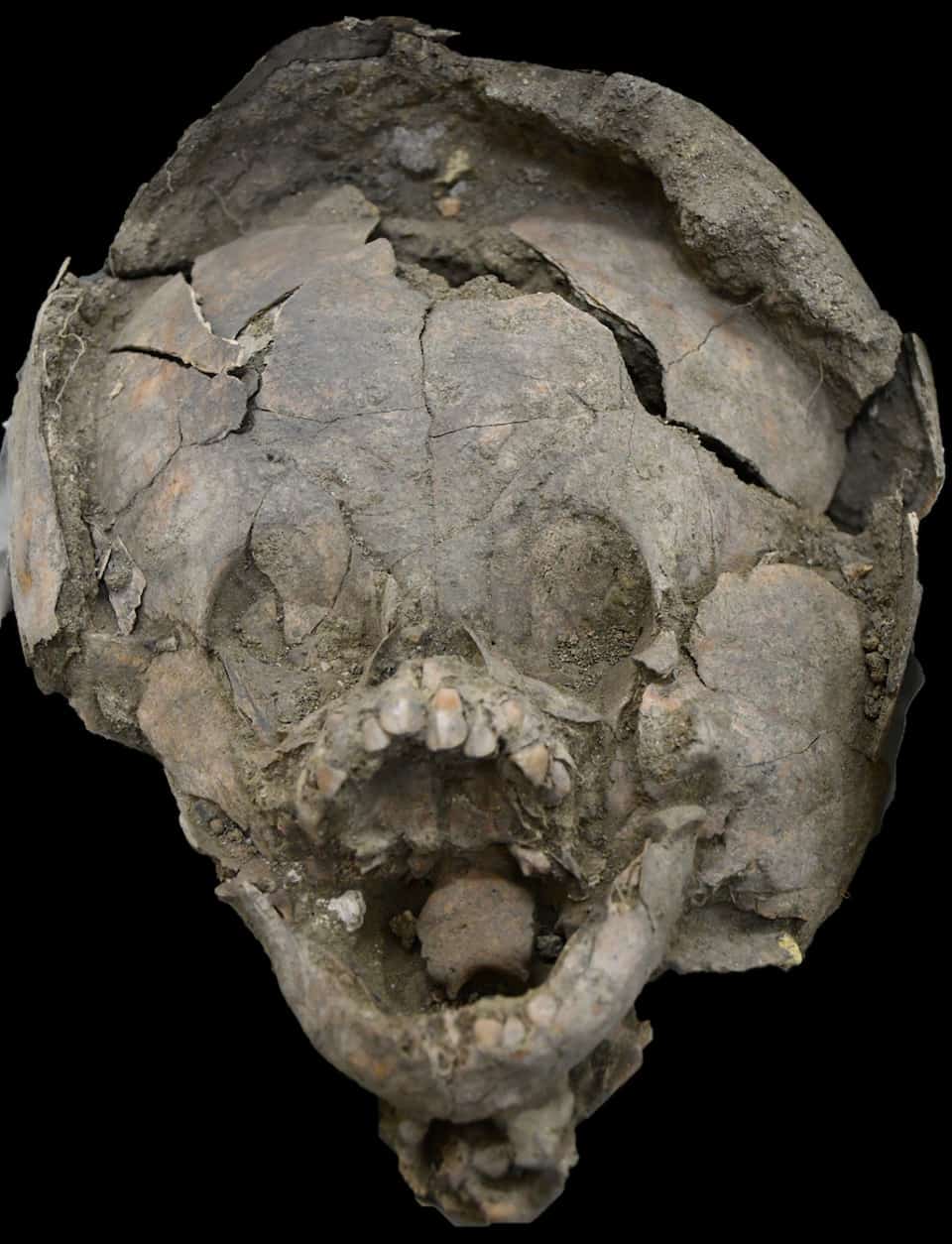 x - Infants found buried in Ecuador were wearing ‘helmets’ made from other children’s skulls
