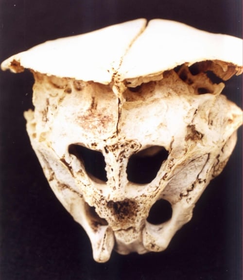 The Rhodope Skull: The mysterious cranium of a real-life Alien?